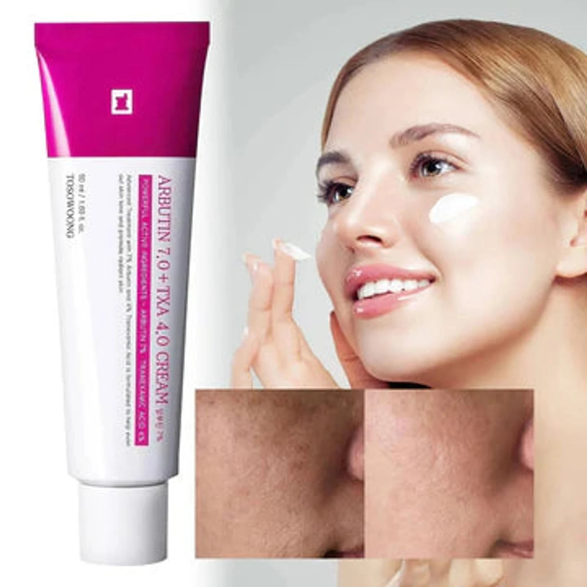 Tosowoong Arbutin 7.0% + TXA 4.0% Brightening Cream 50g